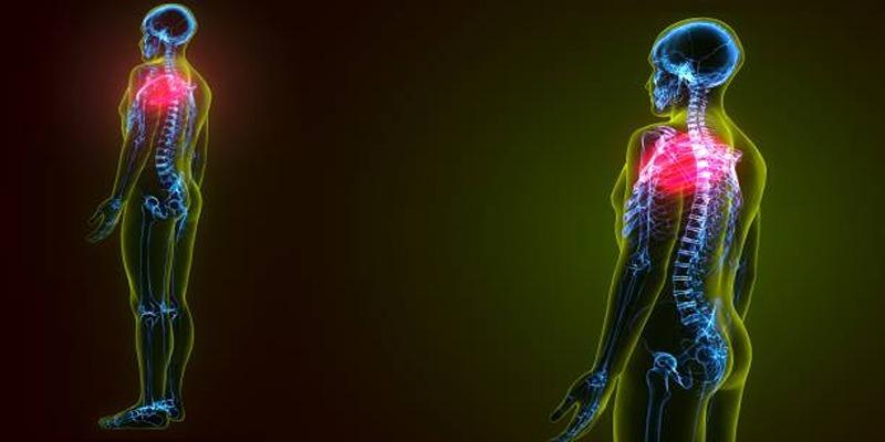 Is Shoulder Pain Linked to Lung Cancer? Signs You Shouldn't Ignore